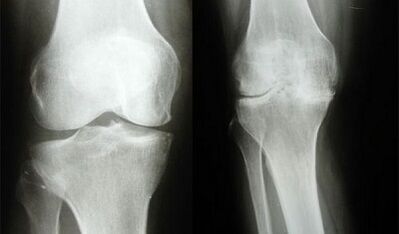 Metody diagnozy kolana