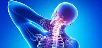 Przyczyny osteochondrozy szyjnej