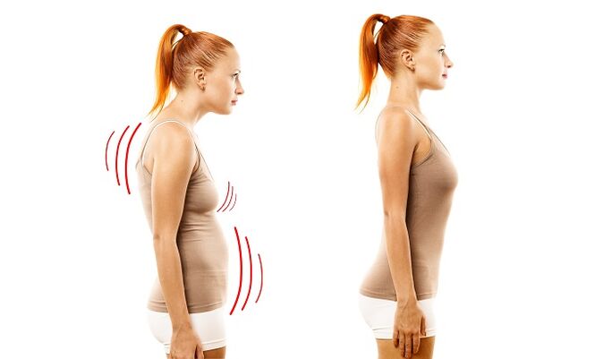 Pochylenie się jako przyczyna rozwoju osteochondrozy lędźwiowej