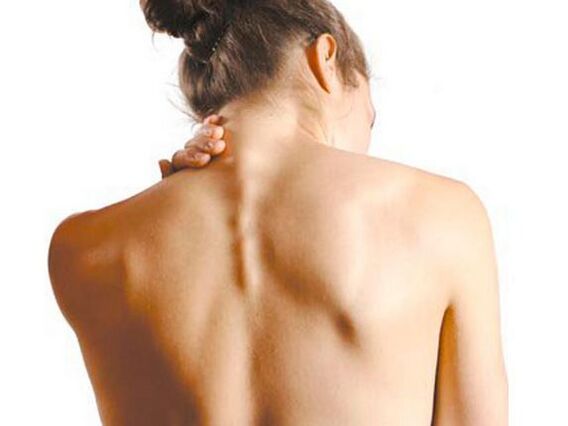 Dziewczyna ma osteochondrozę szyjną
