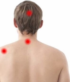miejsce bólu w osteochondrozie szyjnej