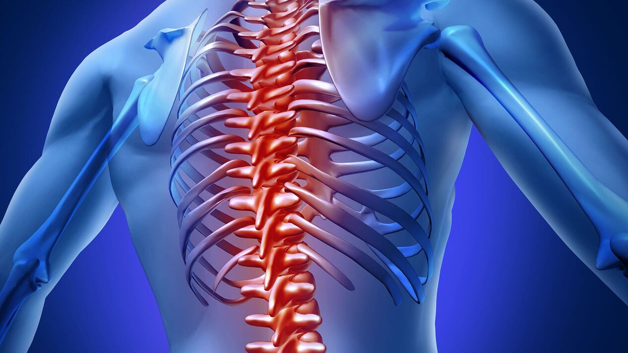 Osteochondroza klatki piersiowej